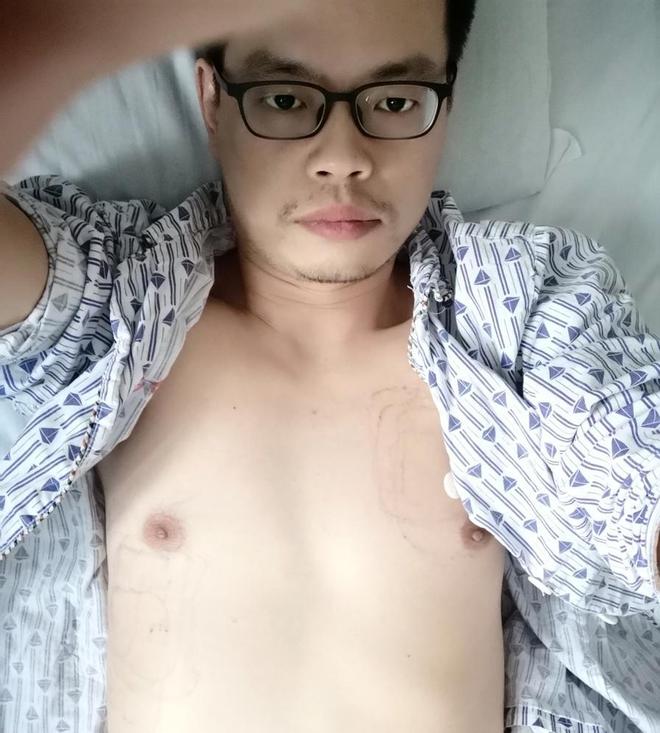 星欧注册:40岁心梗幸存者已离职回村静养,医生回忆抢救过程并提醒:每个人都该保存一份自己健康状态下的心电图